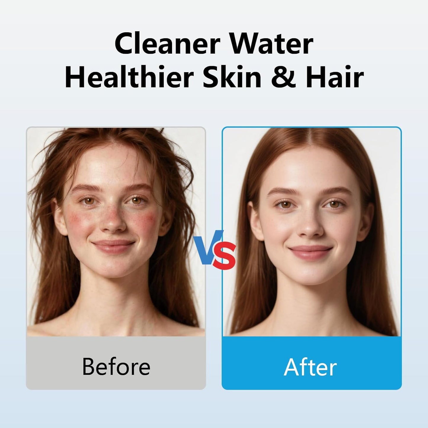 Filtro ducha 20 etapas suaviza agua elimina cloro